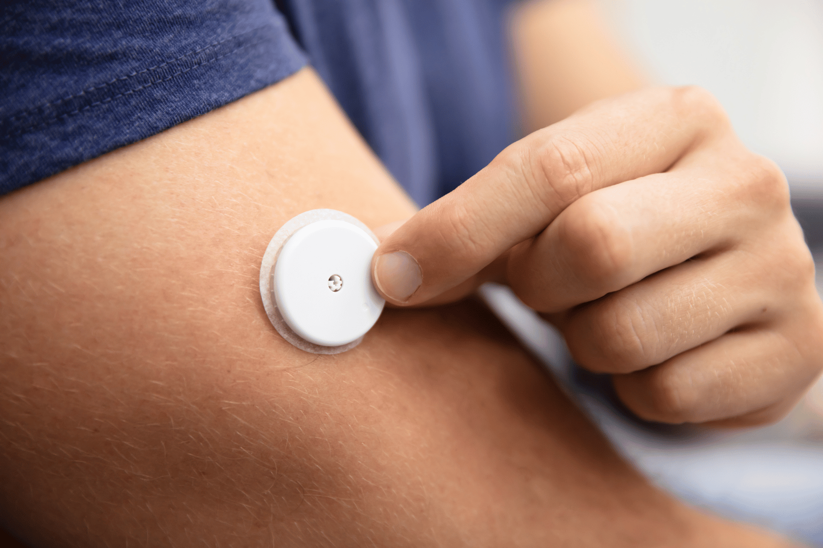 using continuous glucose monitor for remote patient monitoring in decentralized trial